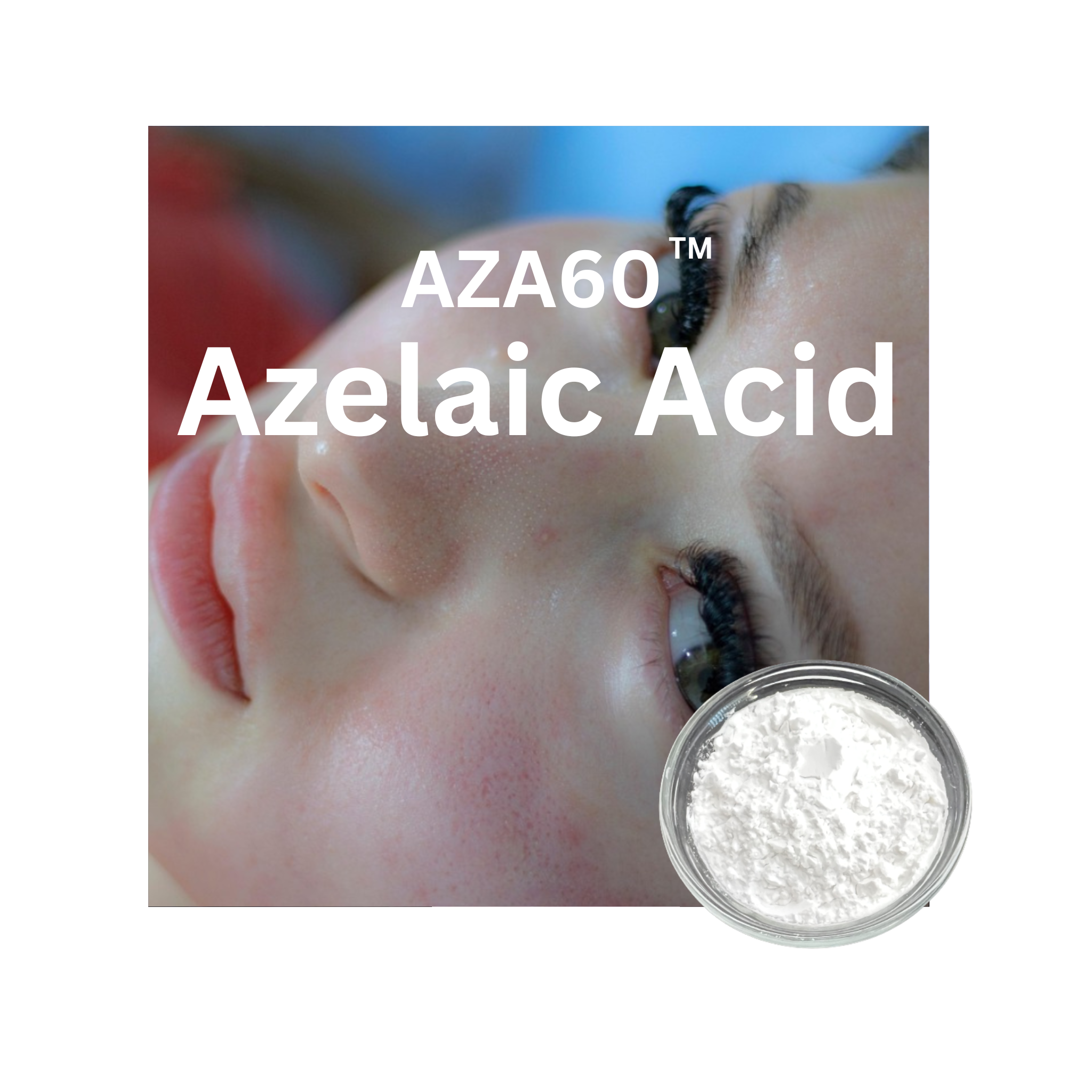 AZA60 -- Azelaic Acid with High Water Solubility, Easy to Use