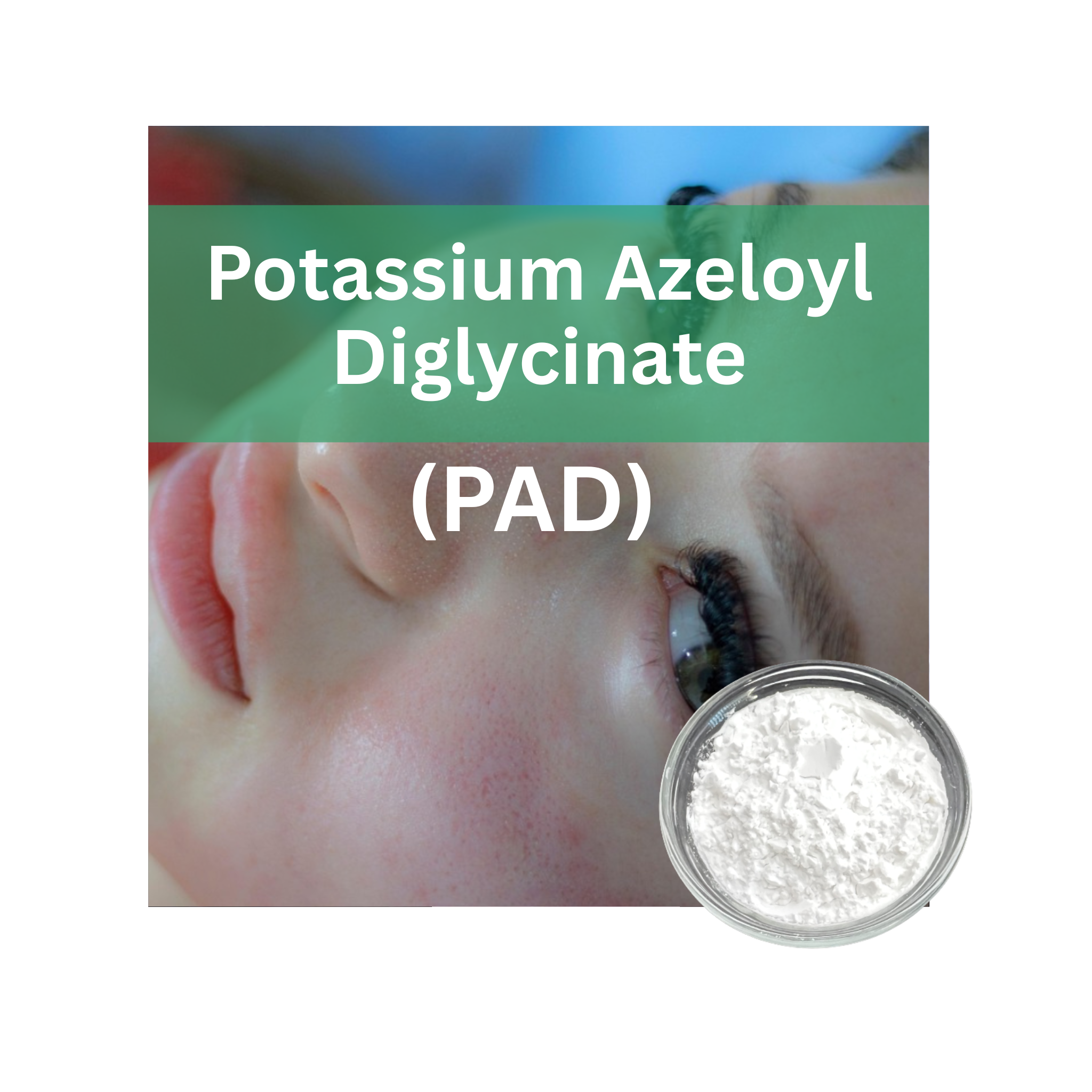 Potassium Azeloyl Diglycinate